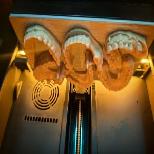 Digital Applications Light-Curing 3D Printed Dental Model Opposite Jaw