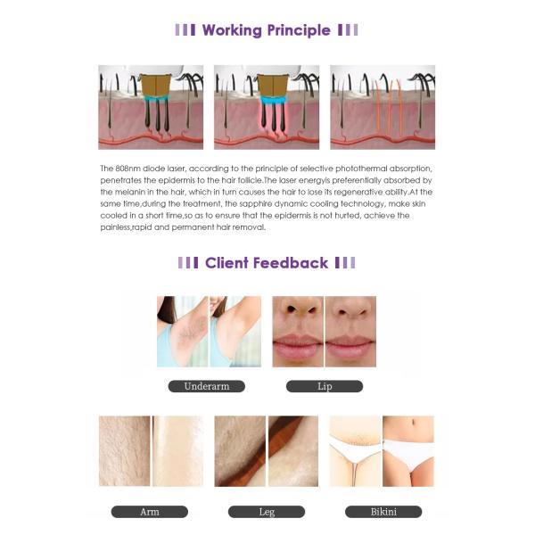 Professional Commercial 808nm Diode Laser Painless Hair Removal Device Machine