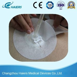 4/6/8/10/12 Full Size Disposable Drainage Catheter Fixation Devices