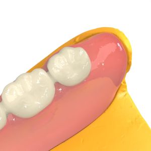 Foundation 3d Printer Dental Resin Customized Biocompatible Resin 3d Printing