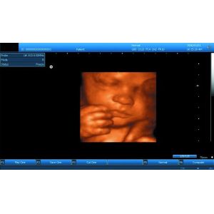 3D Digital B / W Portable Ultrasound Scanner With Convex Linear Transvaginal