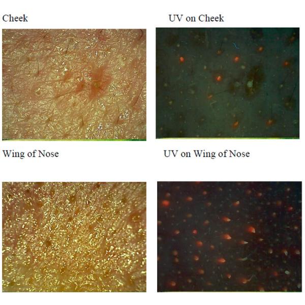 Quality Facial Uv Skin Analyzer Machine For Skin Mositure / Grease / Wrinkle / Pigmentation wholesale