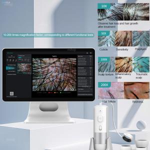 Customizable Scalp Analysis Machine For Dryness And Dandruff Problem