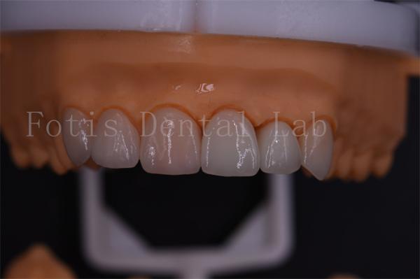 Quality 1 Day Digital Crowns Excellent Compatibility With Easy Transmission Via Email Or Software wholesale