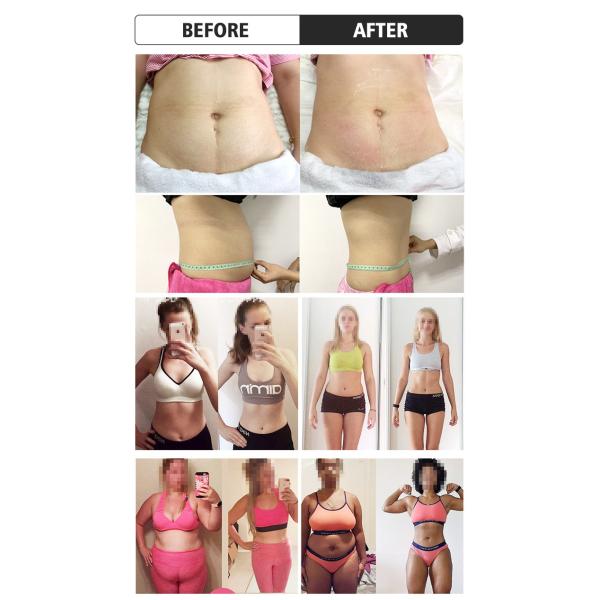 Non Surgical Body Fat Freezing Machine Air Cooling Body Contouring Equipment