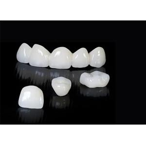 Custom Translucent Zirconia Dental Crown With High Durability Stain Resistant