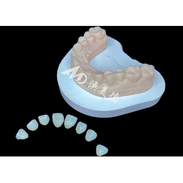 Quality IPS E.max Veneer Premium Aesthetic Solution For Stunning Smile Transformations wholesale