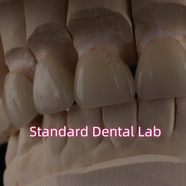 Quality Professional Dental Lab Zirconia Crown For Fixed Restoration wholesale