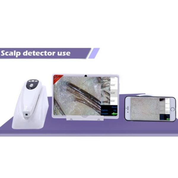 Quality Digital Microscope for Skin and Scalp Video Dermatoscope with 2 Million Pixels wholesale