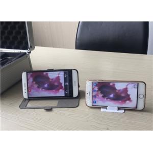 Optional Wifi Model Mini Otoscope Ophthalmoscope With Ultra - High Resolution