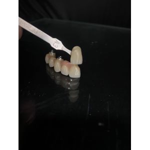 Yucera 98mm Open Precolored ST Color 16 Color Dental Zirconia Block for Dental