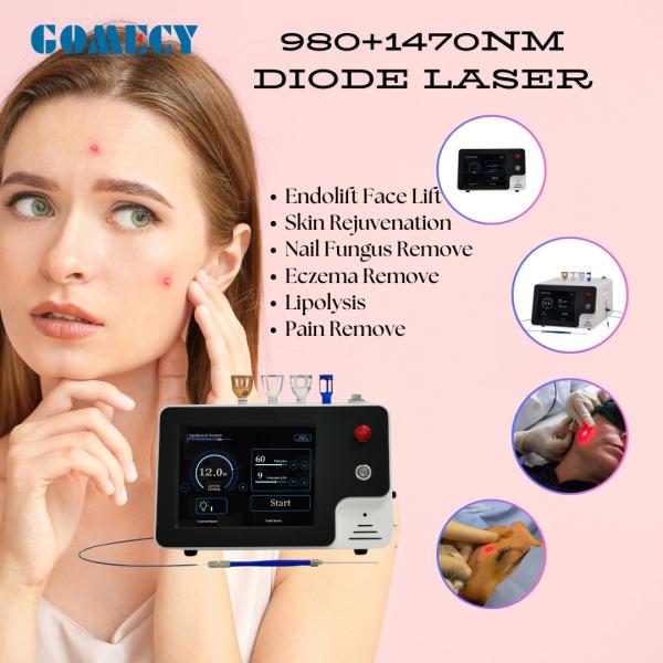 1470nm Endolift Laser Machine For Face Lift Double Chin Shaping And Fat