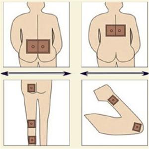 Medical Capsicum Plaster Patch Manufacturing Machine With 800kg Capacity