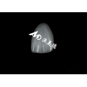 China Natural Esthetics EMAX Veneer Highly Staining Resistant EMAX Ceramic Veneers on sale