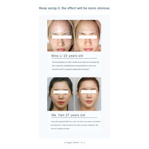 Anti Aging Oxygen Hydrafacial Machine , 9 In 1 Multifunction Facial Machine