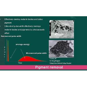 Stationary Style Picosecond Laser Machine 2000W Q Switched Nd YAG Laser Tattoo