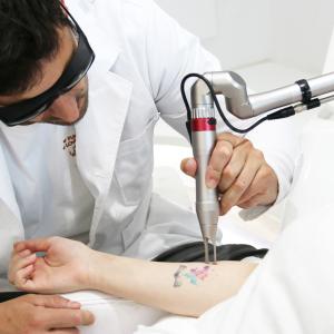 Stationary Style Picosecond Laser Machine 2000W Q Switched Nd YAG Laser Tattoo