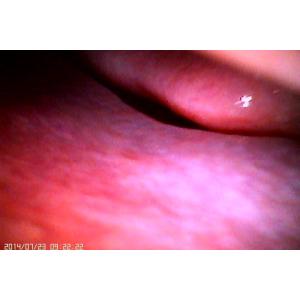 Wifi APP Digital Fundus Camera With Internal Capacity 16GB