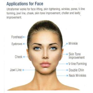 Skin Rejuvenation Machine HIFU Machine Face Lift With Non - Invasive Technology