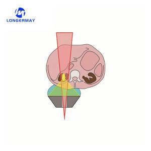 hot selling China ESWL lithotripter machine for sale