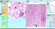 Full-automatic microscope slide scanner with panoramic stitching and depth of field fusion