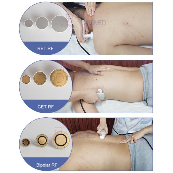 Professional Indiba Radiofrequency Diathermy Tecar Therapy Machine