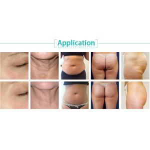 2018 Effective five handles mini cavitation rf vacuum professional slimming