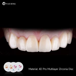Yucera 4D PRO Multilayer Zirconia Blocks Dental Lab CAD CAM Milling Material 43%