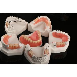 Cheap Hypoallergenic Acrylic Dental Removables Artificial Teeth Removable Partial Denture for sale
