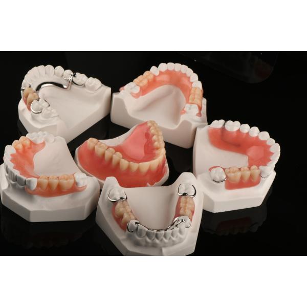 Hypoallergenic Acrylic Dental Removables Artificial Teeth Removable Partial
