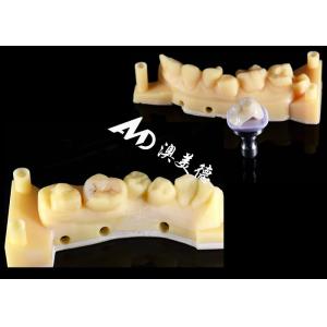 Smooth Hypoallergenic Ceramic Inlays Onlays Custom Fit Stain Resistance High