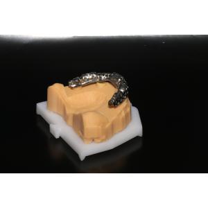 Class 5 All On 4 AOX Implants With Hybrid Titanium Bar / Clips / Metal Mesh /