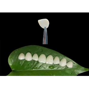 Ultra Thin Ceramic IPS EMAX Veneer Stain Resistance For Esthetic Restorations