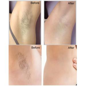 Non Pain 808nm Diode Laser Hair Removal Machine 400ms Pulse Width