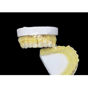 Achieve a Perfect Smile with High Quality Ceramic Dental Crowns for Natural