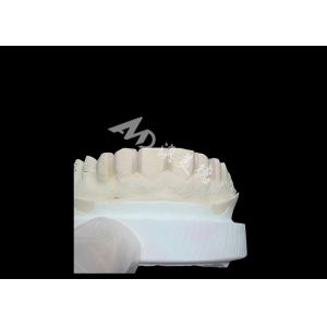 IPS Emax Veneers Minimal Prep/ No-prep Veneers Are Innovative Solutions For