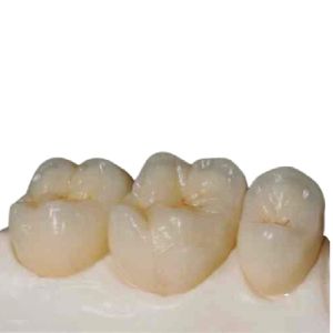 Cheap Computer-aided Manufactured Customized Zirconia Dental Crown for sale