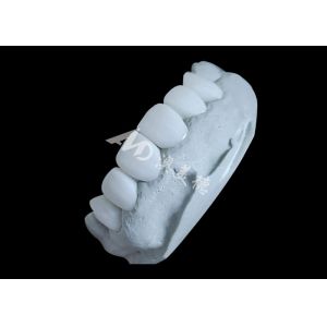 Zirconia Dental Crown Delivering Unbeatable Strength And Natural Smoothness,And