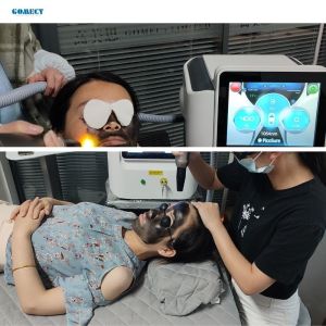 Gomecy Pro ND YAG Pico Laser Machine for Treating Facial Pigmentation and Scars