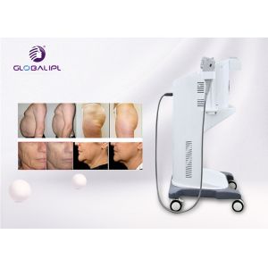 CE Approved HIFU Machine One Shot 11 Lines 2D 3D 4D HIFU 4.0MHz Frequency