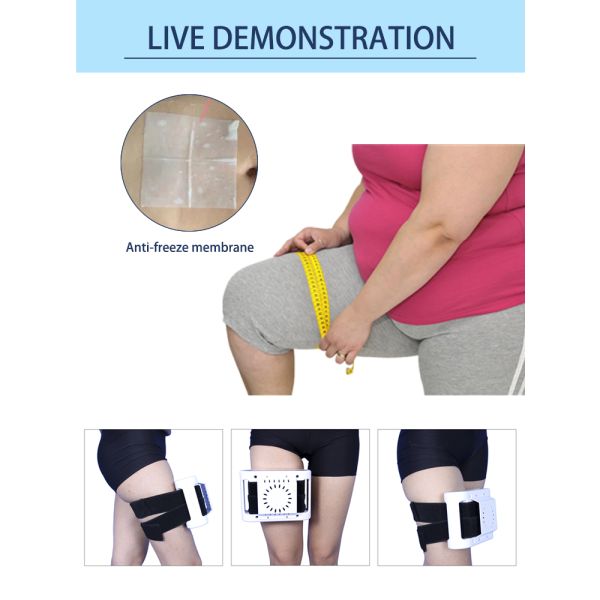 Body Shaping Cryolipolysis Slimming Machine Cryopad Machine 98 * 98mm Treatment Area