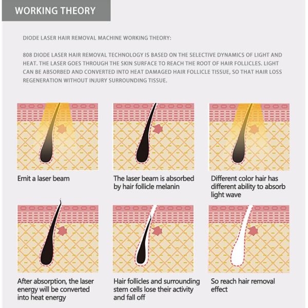 Custom Portable 808nm Diode Laser Hair Removal Machine For Face And Body