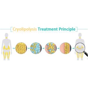 cryo 4 cocoon beauty tighten cryolipolysis system cryo fat freezing cryolipolysi