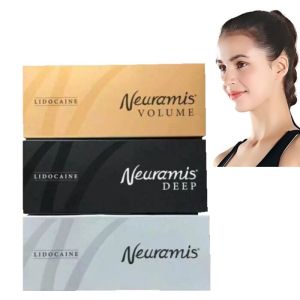 Superficial To Deep Face Treatment With Neuramis Dermal Filler Swelling Side