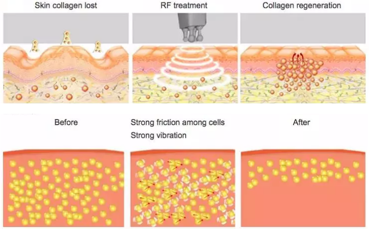 9 In 1 Ultrasonic 40k Cavitation Body Slimming Machine Weight Loss Reshape Beauty