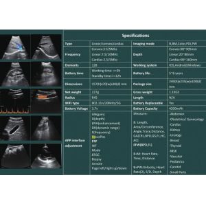5G Handheld Ultrasound Scanner Convex: 3.5~5MHz, Linear: 7.5~10MHz, Cardiac: 2.5