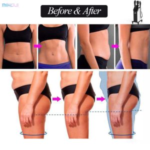 High Efficiency EMT EMS Muscle Sculpting Machine Powerful Electromagnetic Energy
