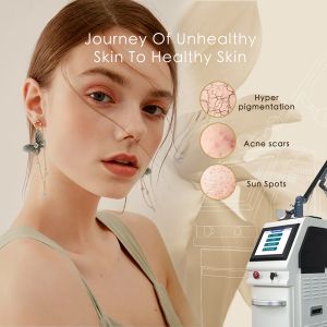 Wrinkle Reduction with 50kg Acne Removal A Winning Combination