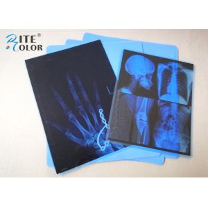 China Low Fog Blue PET Inkjet Medical Imaging Film 8 x 10 Inch For Epson Printer on sale