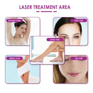 Big High Power Permanently Laser Diodo Portable 808nm Diode Laser Hair Removal